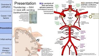 Stroke cerebrovascular accident CVA [upl. by Alleahcim]