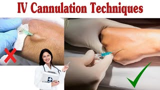 How To Insert IV Cannula  IV Cannulation Techniques [upl. by Lait]