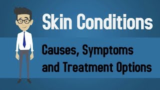 Skin Conditions  Causes Symptoms and Treatment Options [upl. by Enitsed]