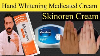 Hand Whitening with Skinoren Cream  How to use skinoren for hand whitening  Dr Nadeem Pharmacist [upl. by Lytton197]