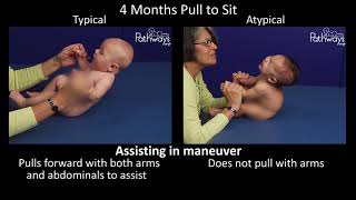 4 Month Old Baby Typical amp Atypical Development Side by Side [upl. by Adnoral]