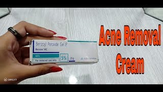 Benzoyl Peroxide 5 Gel Review in Hindi  Acne and Pimples Treatment [upl. by Gadmann961]