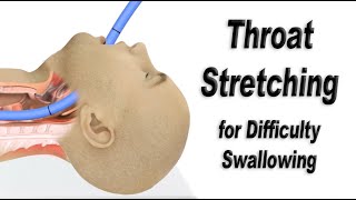 How To Swallow Tablets Easily  Best Easy Way Technique To Swallow Capsules  Difficulty Swallowing [upl. by Naimaj]