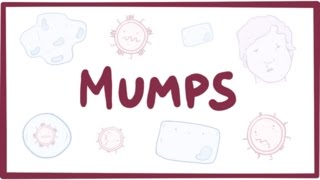 Mumps  symptoms diagnosis treatment pathology [upl. by Hendrika]