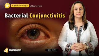 Bacterial Conjunctivitis  Ophthalmology Video Lecture  Medical Student VLearning [upl. by Nnylirret556]