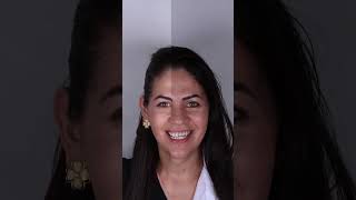 ✅QUAL O VALOR DAS LENTES DE CONTATO DENTAIS  DRA MELISSA LUCENA [upl. by Miza]