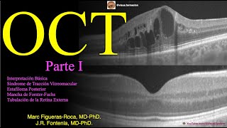 Clase de OCT en Oftalmología y Optometría Parte I [upl. by Oicneconi856]