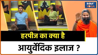 Herpes Disease हरपीज से बचने के 4 योगिकआयुर्वेदिक उपाय जानिए Swami Ramdev से  Yoga Tips [upl. by Ulrich]