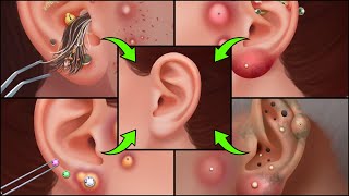 ASMR Happy Hospital  Treatment of the ear  Appointment with an otolaryngologist [upl. by Nahtnamas]