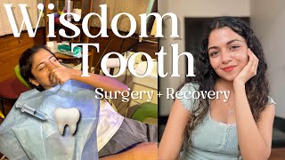 Wisdom tooth removal surgery  recovery and sharing my experience  Hansika Krishna [upl. by Aitsirt]