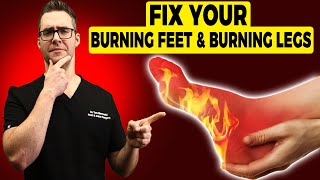 🔥Burning Legs amp Burning Feet at Night Treatment amp Home Remedies🔥 [upl. by Hanny]