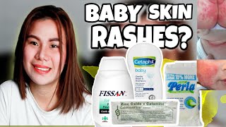 TREATMENT FOR BABY SKIN RASHES AND ITCHING  CALMOSEPTINECETAPHIL amp FISSAN REVIEW [upl. by Aleusnoc]