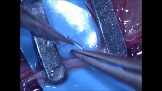 Microsurgical arterial endtoend anastomosis basic technique [upl. by Hibbitts942]