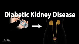 Diabetic Kidney Disease Animation [upl. by Volney]