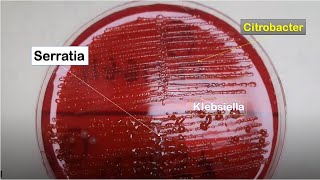 Serratia liquefaciens Citrobacter freundii and Klebsiella pneumoniae Growth on CLED of Urine Cultur [upl. by Premer]