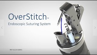 OverStitch™ Endoscopic Suturing System [upl. by Raynata]