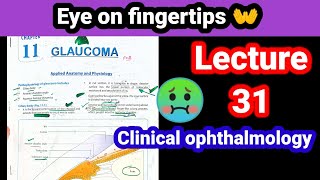 primary open angle glaucoma eye lectures 31 [upl. by Rramed]