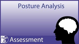 Posture Analysis updated version in description [upl. by Ixela515]