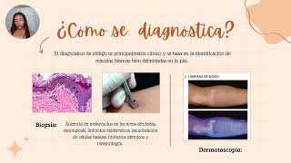 VITÍLIGO EN 8 MINUTOS Definición epidemiología etiopatogénia cuadro clinico DX y TX 👩🏻‍⚕️🩺🧴💕 [upl. by Kramlich]