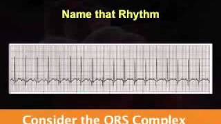 Introduction to EKG Rhythm Interpretation Part 2 [upl. by Nellahs299]