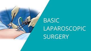 Basic Laparoscopic Surgery [upl. by Anitnuahs]