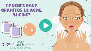 Parches para granitos de acne Si o no [upl. by Asilaj]