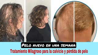 Esta mezcla RECUPERARÁ el cabello que perdiste😭 Cabello fino Calvicie y Crecimiento GARANTIZADO❗️ [upl. by Labannah]