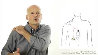 Chest Pain 3 Referred pain [upl. by Atikahs]