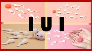 IUI Success Tips [upl. by Haram]