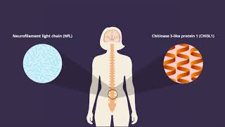 Chitinase 3–like 1 and neurofilament light chain in CSF and CNS atrophy in MS [upl. by Langbehn947]