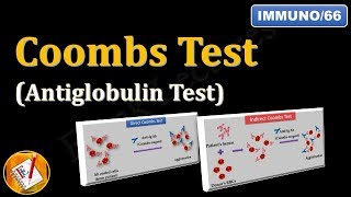 Coombs test or Antiglobulin Test FLImmuno66 [upl. by Ancelin]