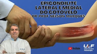 EPICONDILITE MEDIAL e LATERAL DO COTOVELO  Dr Prof Nelson Marques [upl. by Nadine133]