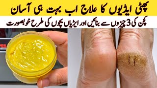 Remove Cracked Heels At Home  Get Beautiful Feet Permanently  Home Remedies [upl. by Aniryt]