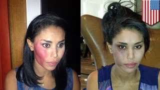 Attacked Donald Sterlings girlfriend VStiviano punched in New York taxi [upl. by Alliuqat]