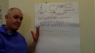 ECG EKG Sinus rhythm and abnormalities [upl. by Lasky848]