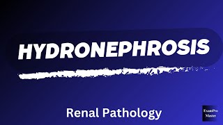 Hydronephrosis  Renal Pathology  Robbins  Easy Explanation [upl. by Orianna]