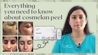 COSMELAN PEEL  SENIOR PRACTITIONERS GUIDE TO Hyperpigmentation treatment [upl. by Lyckman372]