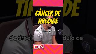 Câncer de tireoide Quando desconfiar endocrinologia tireoide cancer [upl. by Hornstein687]