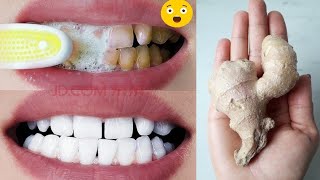 Teeth whitening in 1 minute How to whiten your yellow teeth naturally [upl. by Corso921]