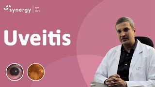 What is Uveitis Whats should you do Uveitis Symptoms and Causes [upl. by Ahsiemak441]