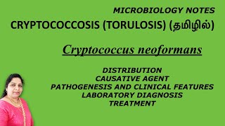 Cryptococcosis Torulosis  Cryptococcus neoformans  pathogenesis lab diagnosis treatment Tamil [upl. by Ogawa]