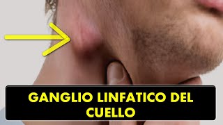 CRECIMIENTO DE GANGLIOS LINFÁTICOS EN LA REGIÓN DEL CUELLO ¿CAUSAS Y TRATAMIENTO [upl. by Cherry993]