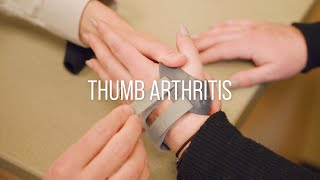 Thumb Arthritis Symptoms Causes and Treatment [upl. by Allred231]