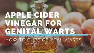 Apple Cider Vinegar for Genital WartsHow to Cure Genital Warts in 34 Days Without A Doctor [upl. by Melville]