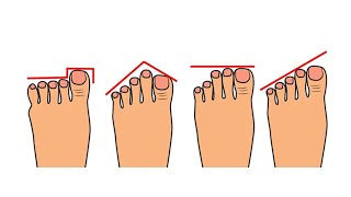Kształt stopy zdradza wiele o Twoim charakterze [upl. by Einej]