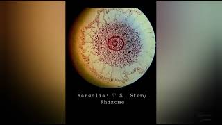 Pteridophyta  Marsilea Permanent Slides of StemRhizome and Sporocarp [upl. by Reeta]