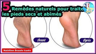 Comment se Débarrasser des Pieds Secs et des Talons Fissurés RAPIDEMENT  Remède Fait Maison [upl. by Pedro21]