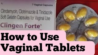 Vaginal tablets kese use krte h How to use Vaginal Tablets [upl. by Ashbey]