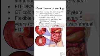 Colon cancer screening [upl. by Anthony108]