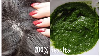 BEST SEBORRHEIC DERMATITIS SCALP TREATMENT  AYURVEDIC DANDRUFF TREATMENT 100 RESULTS IN ONE USE [upl. by Nesta873]